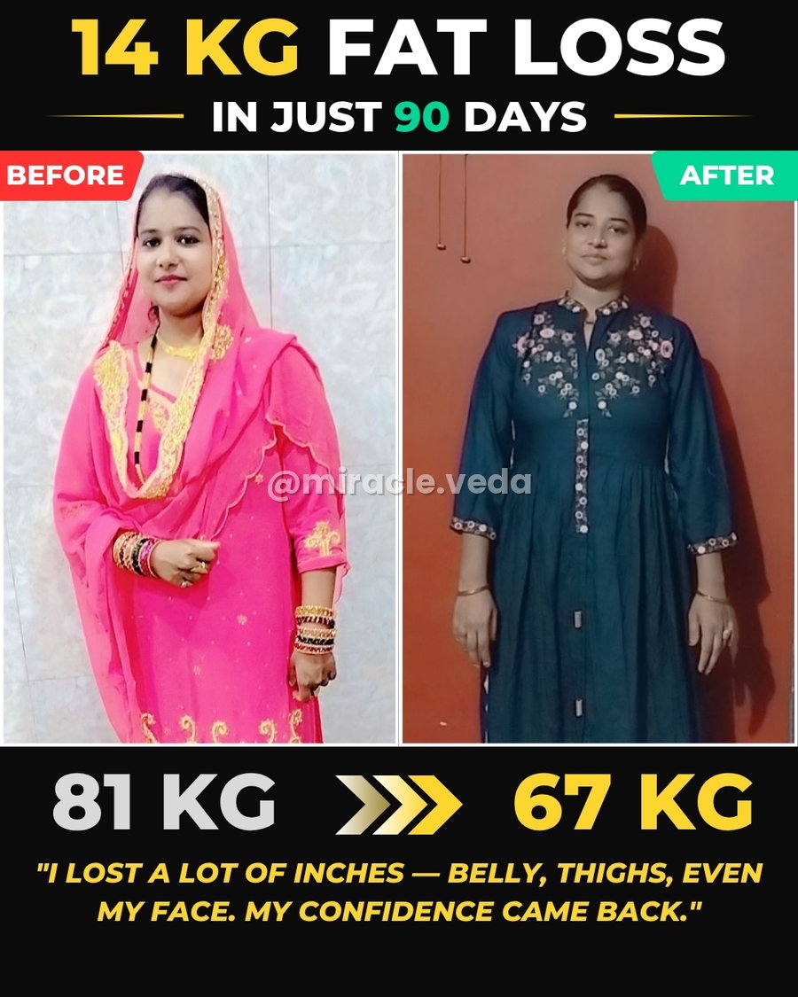 Zainab transformation — Miracle Veda client